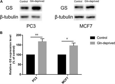 Pharmacological Vitamin C Treatment Impedes the Growth of Endogenous Glutamine-Dependent Cancers by Targeting Glutamine Synthetase